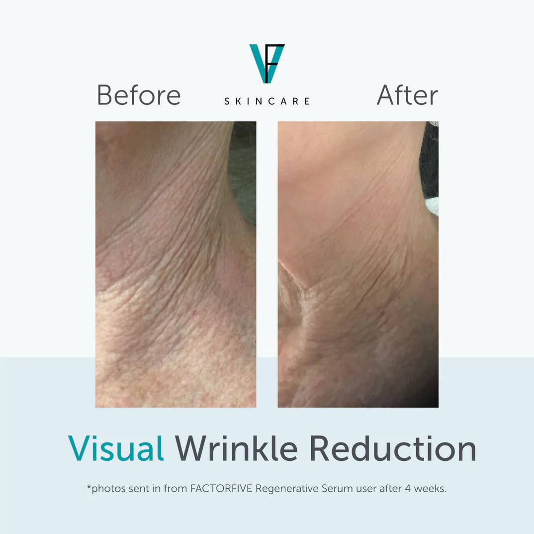 FactorFive Regenerative Serum