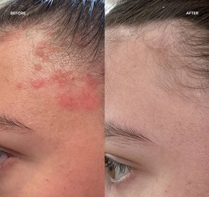 Magic Molecule Antimicrobial Skin Cleanser