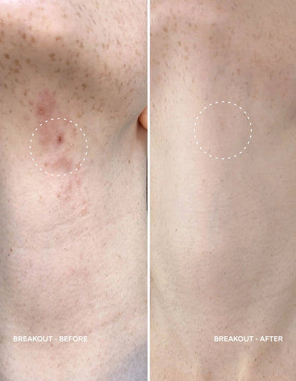 Magic Molecule Antimicrobial Skin Cleanser